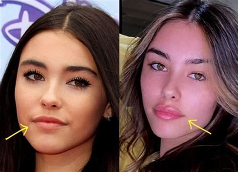 madison beer plastic sugery|Madison Beer Responds To Cosmetic Surgery Allegations